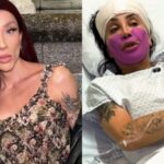 Maya Massafera revela fato inusitado após cirurgia estética e detalha preocupação com o rosto