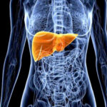 Alerta – Aumento de casos de hepatite A leva Ribeirão Preto a reforçar medidas de controle