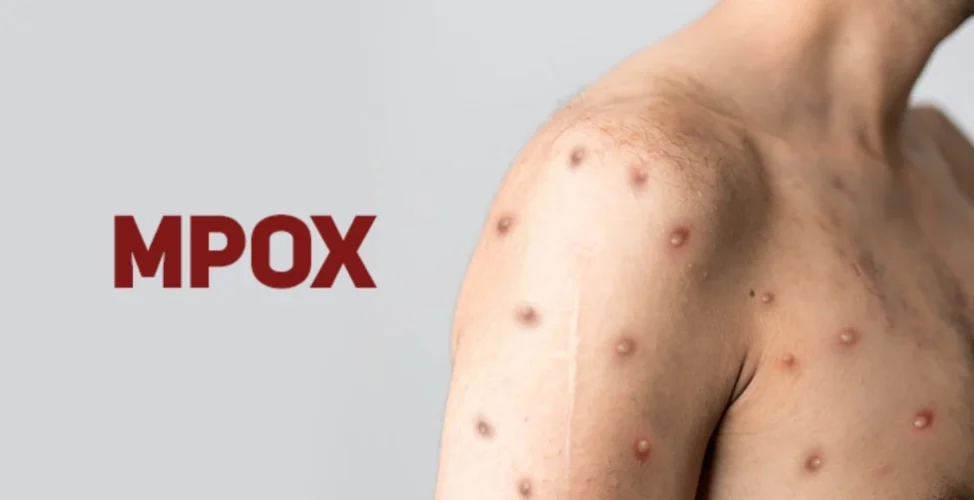 Imagem - Agentes de Saúde e de Endemias BRASIL